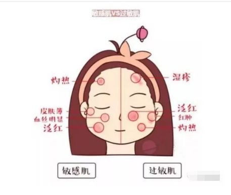 不同膚質應該如何正確護膚？